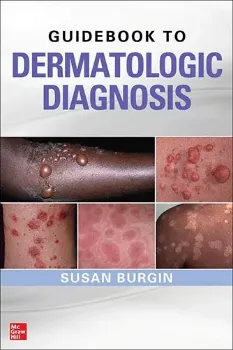 Imagem de Guidebook to Dermatologic Diagnosis