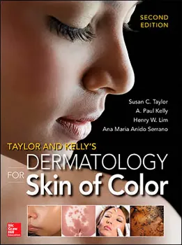 Imagem de Taylor and Kelly's Dermatology for Skin of Color