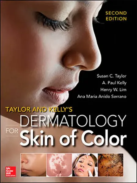 Imagem de Taylor and Kelly's Dermatology for Skin of Color