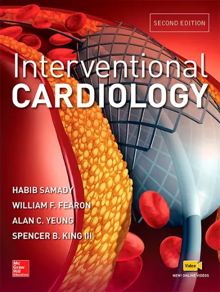 Imagem de Interventional Cardiology