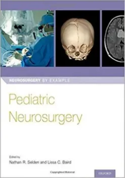 Imagem de Pediatric Neurosurgery