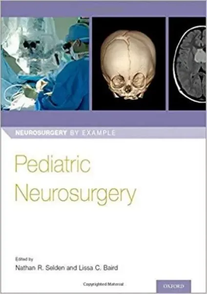 Imagem de Pediatric Neurosurgery