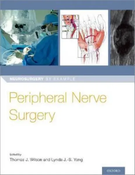Imagem de Peripheral Nerve Surgery