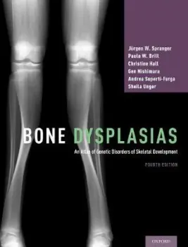 Imagem de Bone Dysplasias: An Atlas of Genetic Disorders of Skeletal Development