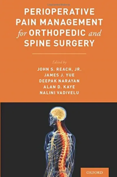 Imagem de Perioperative Pain Management for Orthopedic and Spine Surgery