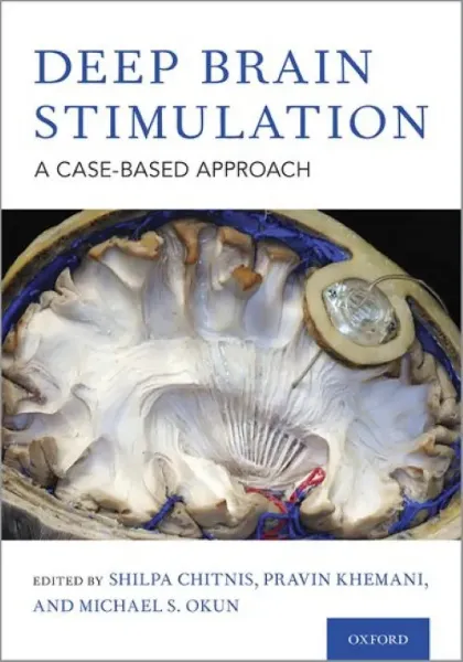 Imagem de Deep Brain Stimulation: Case-Based Approach