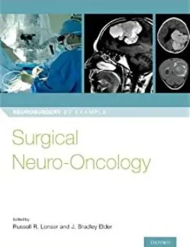 Imagem de Surgical Neuro-Oncology