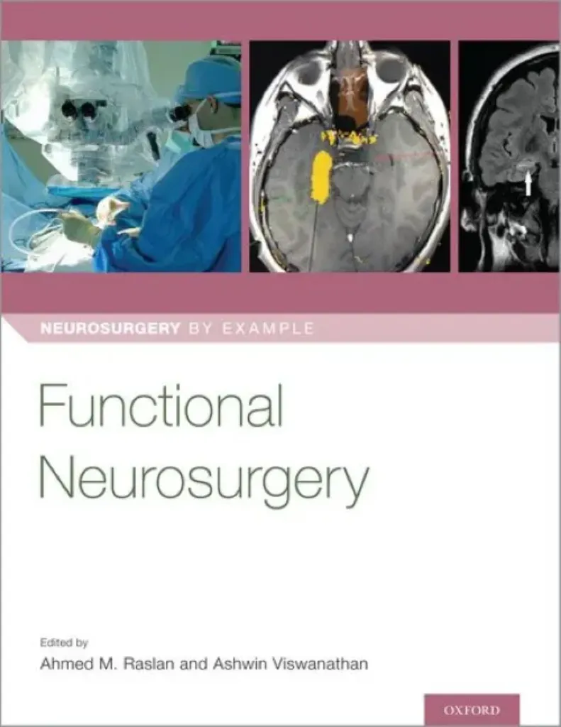 Imagem de Functional Neurosurgery