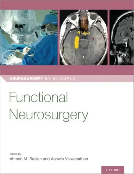 Imagem de Functional Neurosurgery
