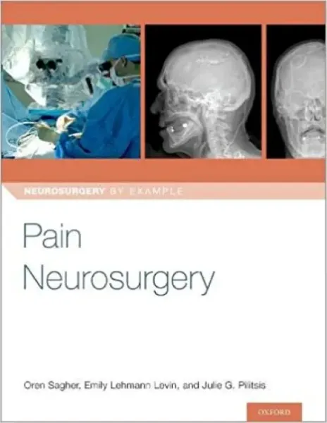 Imagem de Pain Neurosurgery