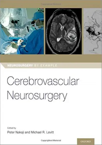 Imagem de Cerebrovascular Neurosurgery