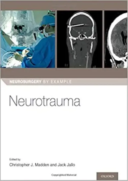 Imagem de Neurotrauma