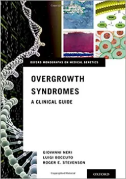 Imagem de Overgrowth Syndromes: A Clinical Guide