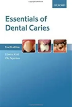 Imagem de Essentials of Dental Caries