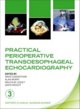 Imagem de Practical Perioperative Transoesophageal Echocardiography