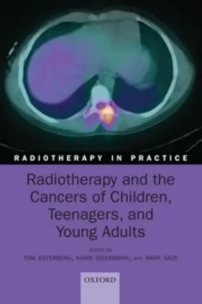 Imagem de Radiotherapy and the Cancers of Children, Teenagers, and Young Adults