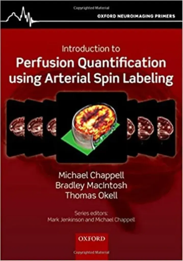 Imagem de Introduction to Perfusion Quantification using Arterial Spin Labelling