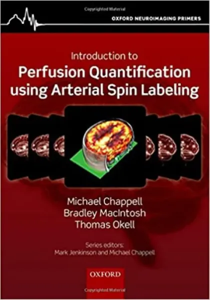 Imagem de Introduction to Perfusion Quantification using Arterial Spin Labelling