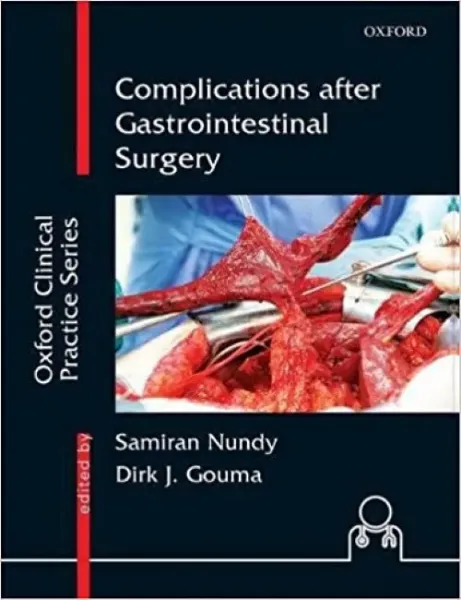 Imagem de Complications After Gastrointestinal Surgery