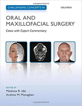 Imagem de Challenging Concepts in Oral and Maxillofacial Surgery: Cases with Expert Commentary