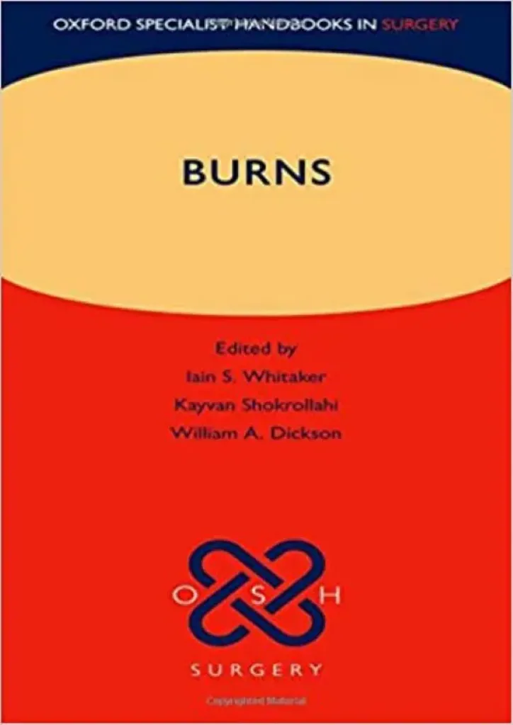 Imagem de Burns