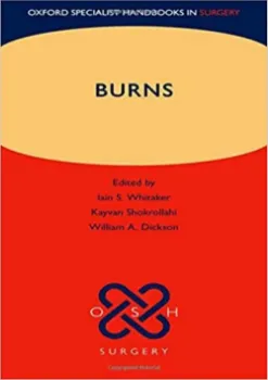 Picture of Book Burns