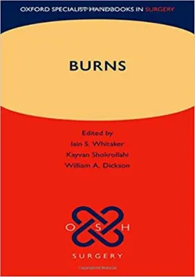 Picture of Book Burns