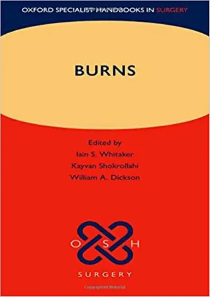 Imagem de Burns