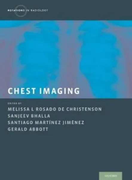 Imagem de Chest Imaging