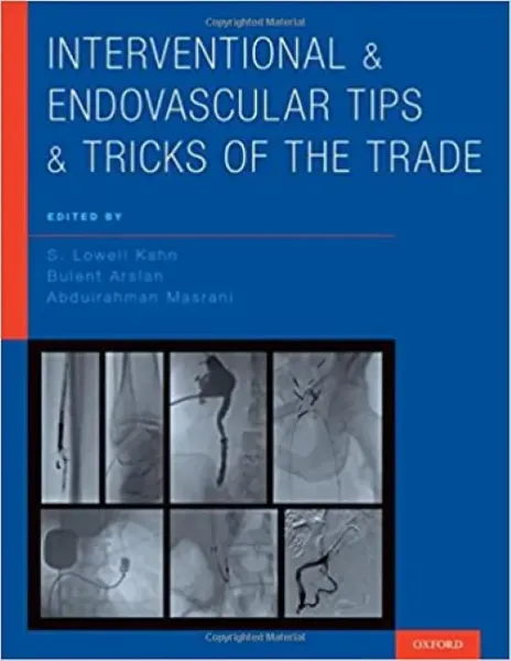Imagem de Interventional and Endovascular Tips and Tricks of the Trade