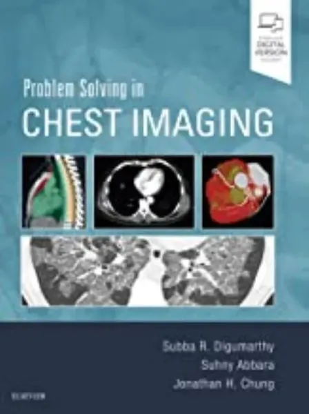 Imagem de Problem Solving in Chest Imaging