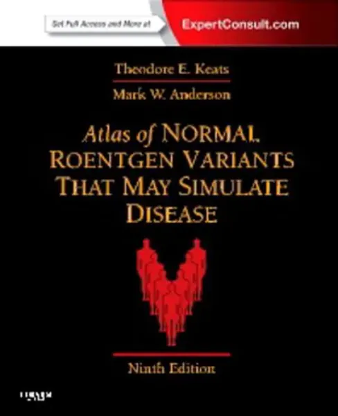 Imagem de Atlas of Normal Roentgen Variants That May Simulate Disease