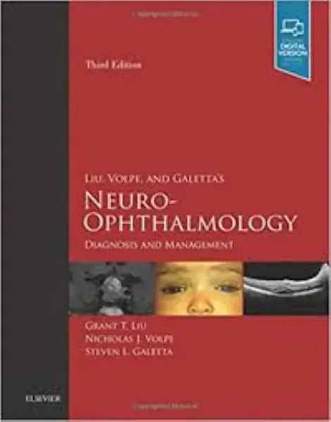 Imagem de Liu, Volpe, and Galetta's Neuro-Ophthalmology