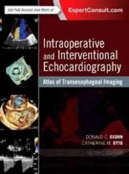 Imagem de Intraoperative and Interventional Echocardiography
