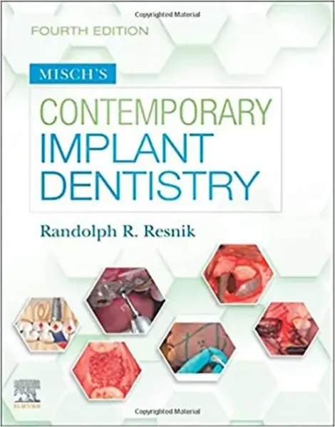 Imagem de Misch's
 Contemporary Implant Dentistry