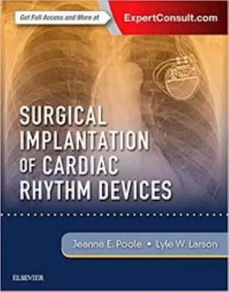 Imagem de Surgical Implantation of Cardiac Rhythm Devices