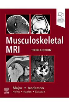 Imagem de Musculoskeletal MRI
