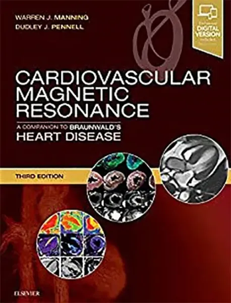 Imagem de Cardiovascular Magnetic Resonance