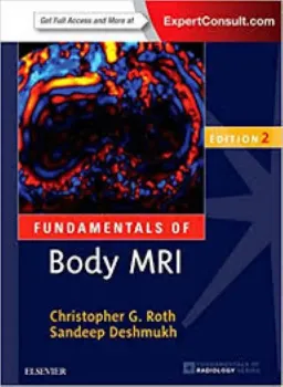 Imagem de Fundamentals of Body MRI