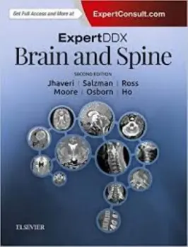 Imagem de Expert DDX Brain and Spine