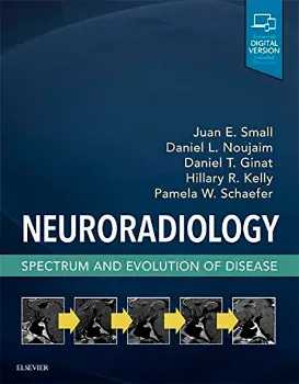 Imagem de Neuroradiology: Spectrum and Evolution of Disease