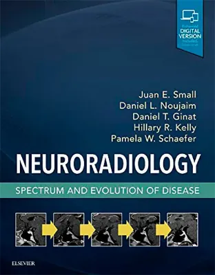 Imagem de Neuroradiology: Spectrum and Evolution of Disease
