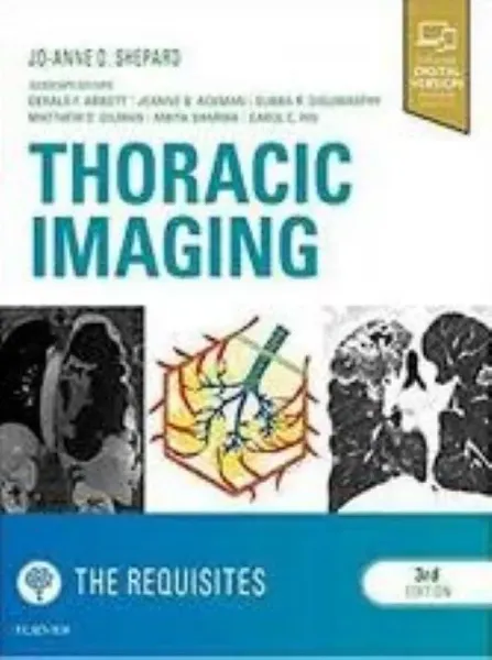 Imagem de Thoracic Imaging: The Requisites