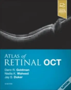 Imagem de Atlas of Retinal OCT: Optical Coherence Tomography