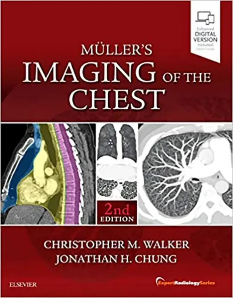 Imagem de Muller's Imaging of the Chest
