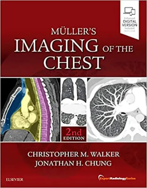 Imagem de Muller's Imaging of the Chest