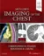 Imagem de Muller's Imaging of the Chest