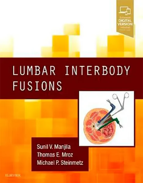 Imagem de Lumbar Interbody Fusions