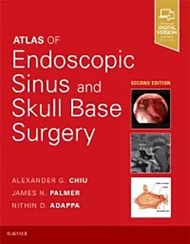 Imagem de Atlas of Endoscopic Sinus and Skull Base Surgery