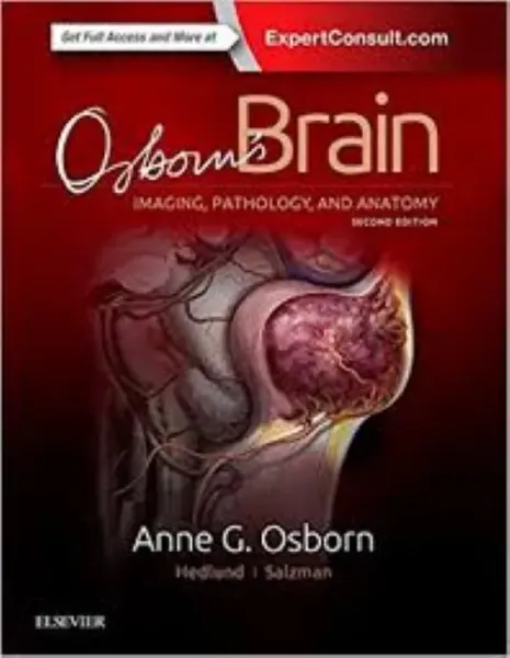 Imagem de Osborn's Brain